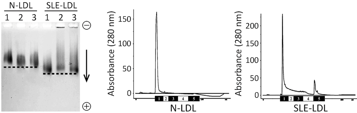 圖二 以電泳及液相層析法證實SLE病人的LDL陰電性增加